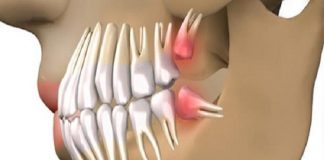Zbulim revolucionar, Thuaji lamtumirë implanteve dentare dhe rritini dhëmbët tuaj brenda 9 javëve.