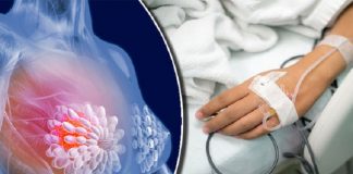 Kanceri i gjirit: A i njihni 7 shenjat e kancerit të gjoksit?