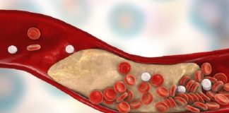 Ja me çfarë ushqimi ju do të pastroni arteriet tuaja