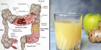 Duke pirë një gotë me këtë lëng, ju do te pastroni zorret ku dhe do te humbisni peshe!