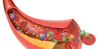 Shiko cila llojë ëmbëlsire pastron më mirë arteriet tuaj!