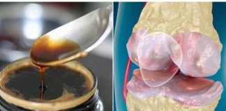 Trajtimi për forcimin e kockave dhe nyjeve