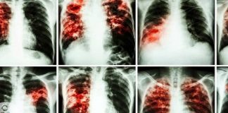 Kujdes: Ata janë më kancerogjenë se pirja e duhanit dhe ne të gjithë i përdorim ato çdo ditë