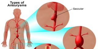Fryerja:Një armik shumë i vështirë! – Simptomat për të cilën duhet të keni kujdes!