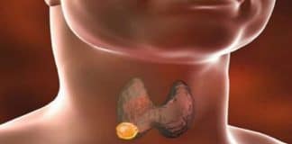 Tiroidet: Pra kështu ju do të kuptoni nese ju keni një problem serioz!