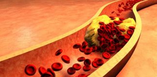 Fruti që pastron dhe mban arteriet të shëndetshme