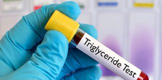 8 mënyra natyrale për të ulur nivelet e triglicerideve në gjak