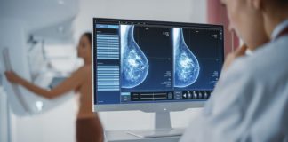 Çfarë mund të na thotë një mamografi për zemrën tonë?