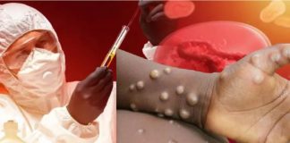 Vdekjet e para në Europë nga lija e majmunëve