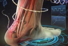 Qepja elektronike monitoron shërimin e mirë të plagëve