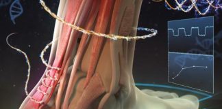 Qepja elektronike monitoron shërimin e mirë të plagëve