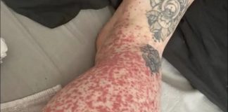 Këto janë pasojat e cuditshme por ndonjëherë dhe të rrezikshme …